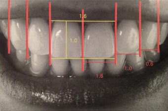 前歯の並びの比率